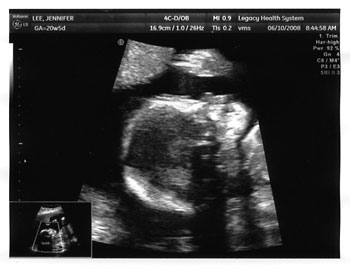 Taran Jack Manley, 20 weeks and counting.